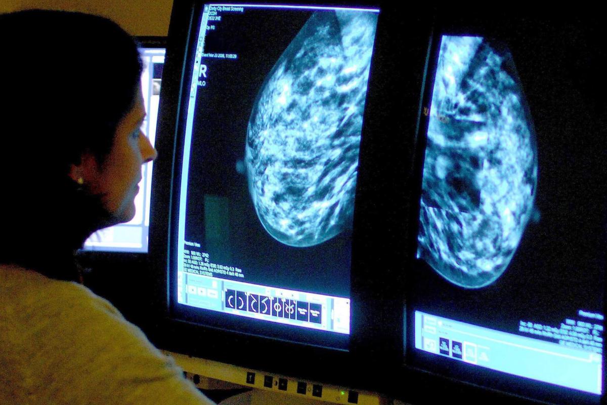 Understanding Breast Cancer: Symptoms, Causes, and Treatments Explained